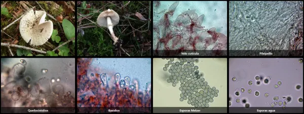 Microscopía de Amanita citrina