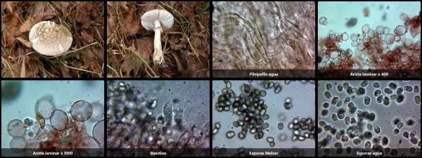 Microscopía de Amanita franchetii