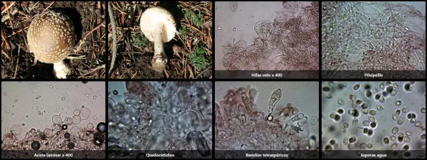 Microscopía de Amanita pantherina