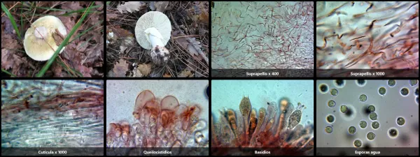 Microscopía de Amanita phalloides