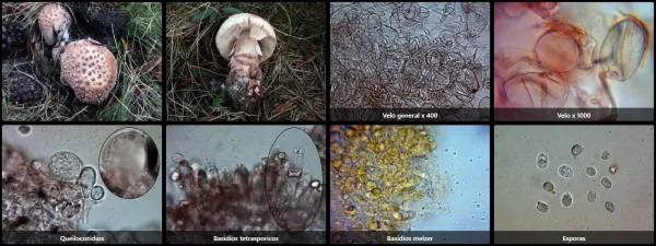 Microscopía de Amanita rubescens