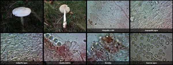 Microscopía de Amanita vaginata