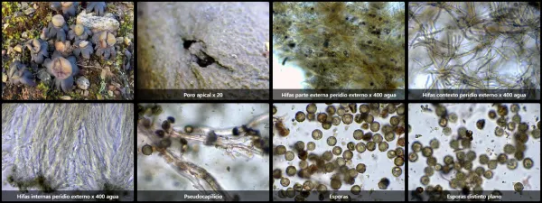 Microscopía de Astraeus hygrometricus