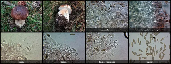 Microscopía de Boletus edulis