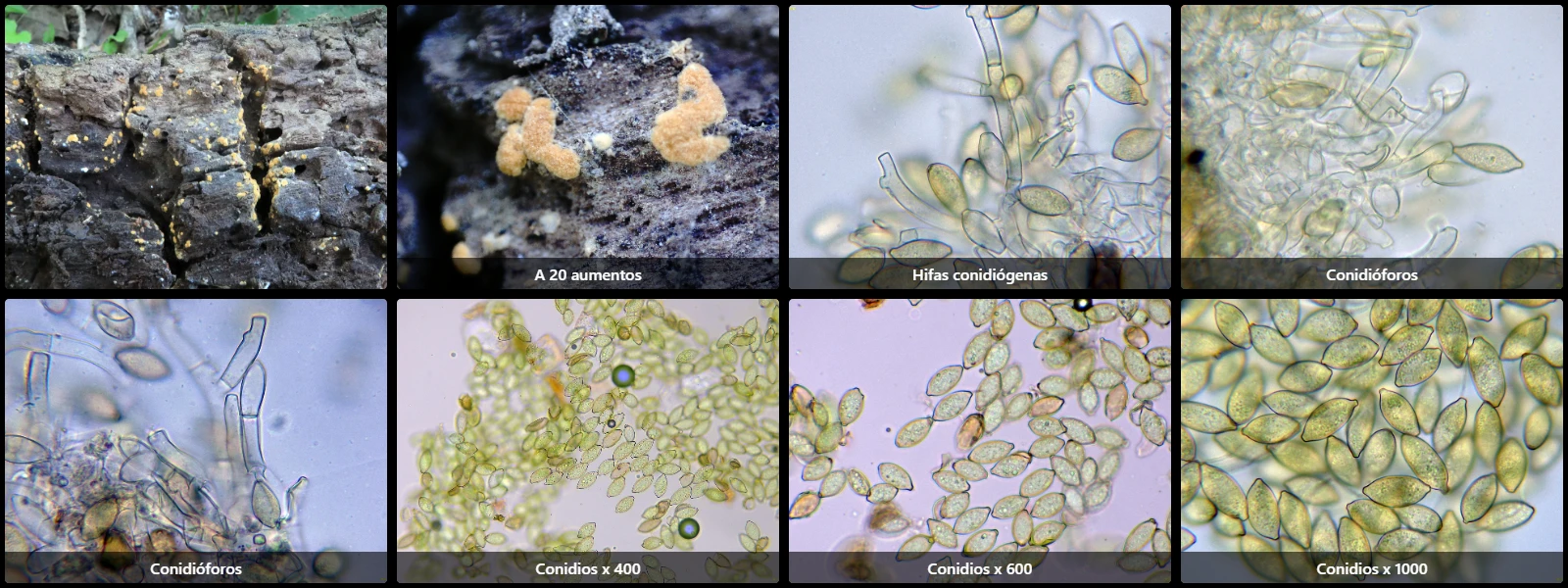 Botryobasidium aureum