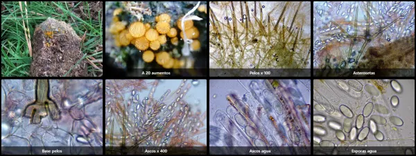 Microscopía de Cheilymenia stercorea