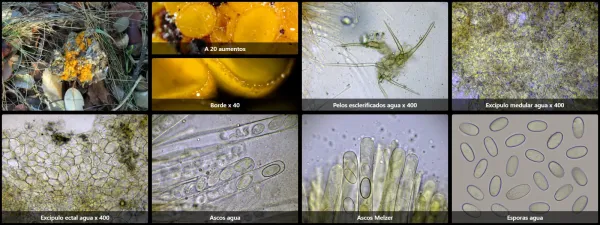 Cheilymenia theleboloides