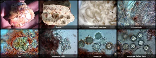 Microscopía de Choiromyces meandriformis