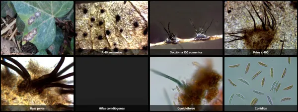 Colletotrichum trichellum