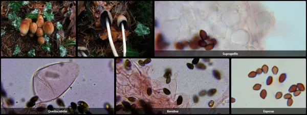 Microscopía de Coprinellus micaceus