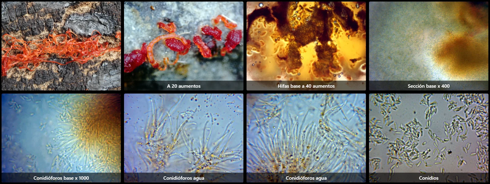 Cytospora chrysosperma